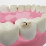 Are teeth bones? Debunking the Common Misconception